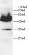 CD36 Molecule antibody, FNab10787, FineTest, Western Blot image 