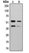 Stromelysin-2 antibody, orb216158, Biorbyt, Western Blot image 