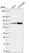 Dihydrolipoamide S-Acetyltransferase antibody, HPA062766, Atlas Antibodies, Western Blot image 