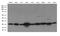 Caseinolytic Mitochondrial Matrix Peptidase Proteolytic Subunit antibody, GTX84678, GeneTex, Western Blot image 