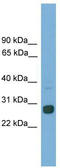 MAX Dimerization Protein 1 antibody, TA342278, Origene, Western Blot image 
