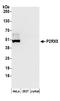 P2X purinoceptor 5 antibody, A304-412A, Bethyl Labs, Western Blot image 