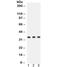 Cyclin D1 antibody, R32025, NSJ Bioreagents, Western Blot image 
