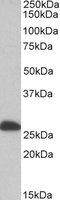 Electron transfer flavoprotein subunit beta antibody, LS-B9219, Lifespan Biosciences, Western Blot image 