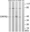 Corticotropin Releasing Hormone Receptor 2 antibody, TA313695, Origene, Western Blot image 