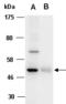 Nuclear Receptor Coactivator 1 antibody, orb66875, Biorbyt, Western Blot image 