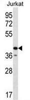 Golgi Reassembly Stacking Protein 2 antibody, AP51894PU-N, Origene, Western Blot image 