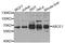 ATP Binding Cassette Subfamily E Member 1 antibody, STJ110445, St John