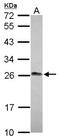 Lin-7 Homolog A, Crumbs Cell Polarity Complex Component antibody, NBP2-15016, Novus Biologicals, Western Blot image 