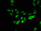 RNA Binding Motif Protein 10 antibody, A63294-100, Epigentek, Immunofluorescence image 