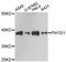 PIH1 Domain Containing 1 antibody, A08223, Boster Biological Technology, Western Blot image 