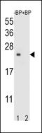 Transmembrane 4 L Six Family Member 4 antibody, LS-C161671, Lifespan Biosciences, Western Blot image 
