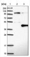 DnaJ Heat Shock Protein Family (Hsp40) Member B7 antibody, NBP1-81692, Novus Biologicals, Western Blot image 