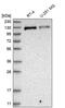 rTS antibody, PA5-55263, Invitrogen Antibodies, Western Blot image 