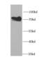 Hematopoietic Cell-Specific Lyn Substrate 1 antibody, FNab03786, FineTest, Western Blot image 