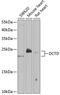 DCMP Deaminase antibody, GTX33147, GeneTex, Western Blot image 