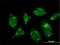 RAB GTPase Activating Protein 1 antibody, H00023637-M01, Novus Biologicals, Immunocytochemistry image 