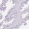 Fatty Acid Binding Protein 5 antibody, NBP2-38659, Novus Biologicals, Immunohistochemistry paraffin image 