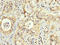 Peroxisomal targeting signal 1 receptor antibody, LS-C670915, Lifespan Biosciences, Immunohistochemistry paraffin image 