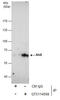 NGFI-A-binding protein 2 antibody, GTX114568, GeneTex, Immunoprecipitation image 