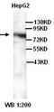 FMR1 Autosomal Homolog 1 antibody, orb77191, Biorbyt, Western Blot image 