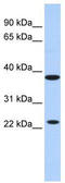 T-cell surface glycoprotein YE1/48 antibody, TA341851, Origene, Western Blot image 