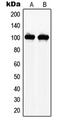 N(Alpha)-Acetyltransferase 15, NatA Auxiliary Subunit antibody, MBS820931, MyBioSource, Western Blot image 