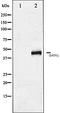 Renal carcinoma antigen NY-REN-26 antibody, orb106363, Biorbyt, Western Blot image 