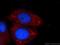 Putative protein TIGA1 antibody, 24698-1-AP, Proteintech Group, Immunofluorescence image 