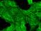 Glutamate Ionotropic Receptor NMDA Type Subunit 2B antibody, NBP1-47611, Novus Biologicals, Immunocytochemistry image 
