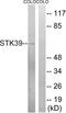 Serine/Threonine Kinase 39 antibody, abx012938, Abbexa, Western Blot image 