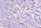 Cathepsin K antibody, A53433-100, Epigentek, Immunohistochemistry paraffin image 