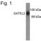 Solute Carrier Family 6 Member 3 antibody, PA1-4657, Invitrogen Antibodies, Western Blot image 