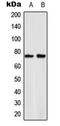 p65 antibody, LS-C354088, Lifespan Biosciences, Western Blot image 