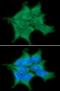 Protein Phosphatase, Mg2+/Mn2+ Dependent 1G antibody, NBP1-04337, Novus Biologicals, Immunocytochemistry image 