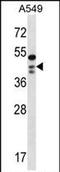 STN1 Subunit Of CST Complex antibody, PA5-71969, Invitrogen Antibodies, Western Blot image 