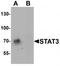STAT3 antibody, TA319710, Origene, Western Blot image 