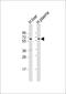 Protein C, Inactivator Of Coagulation Factors Va And VIIIa antibody, 57-108, ProSci, Western Blot image 