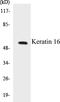 Keratin 16 antibody, EKC1322, Boster Biological Technology, Western Blot image 