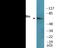 Paxillin antibody, EKC2491, Boster Biological Technology, Western Blot image 