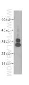 Centromere Protein H antibody, 12841-1-AP, Proteintech Group, Western Blot image 