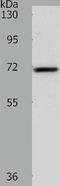 SRY-Box 13 antibody, TA321719, Origene, Western Blot image 