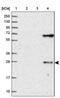 Sushi Domain Containing 3 antibody, PA5-59944, Invitrogen Antibodies, Western Blot image 