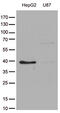 Galactose Mutarotase antibody, M07597, Boster Biological Technology, Western Blot image 