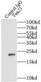 Translocase Of Inner Mitochondrial Membrane 23 antibody, FNab08693, FineTest, Immunoprecipitation image 