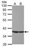 ETS Transcription Factor ELK3 antibody, GTX114966, GeneTex, Western Blot image 