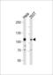 EPH Receptor A10 antibody, MBS9202492, MyBioSource, Western Blot image 