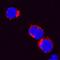 C-X-C Motif Chemokine Ligand 8 antibody, PA5-47289, Invitrogen Antibodies, Immunocytochemistry image 