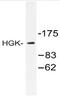 Mitogen-activated protein kinase kinase kinase kinase 4 antibody, AP20403PU-N, Origene, Western Blot image 