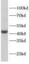 Adiponectin Receptor 1 antibody, FNab10402, FineTest, Western Blot image 